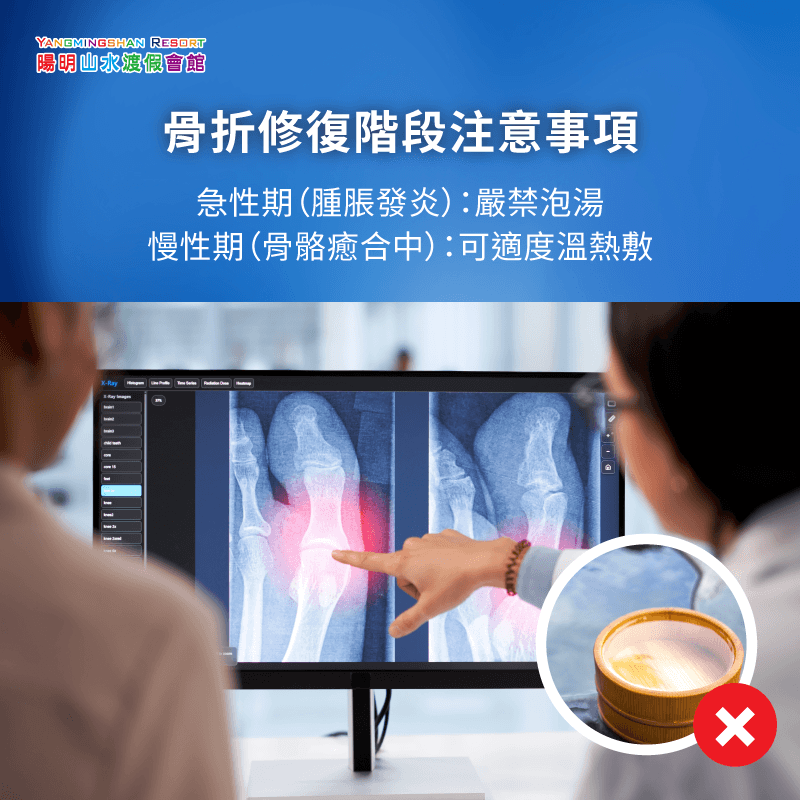 骨折修復階段與泡溫泉時機 骨裂修復階段可以泡湯嗎-骨裂可以泡溫泉嗎
