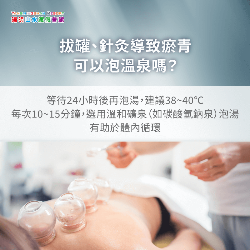拔罐針灸瘀青可以泡溫泉嗎-瘀青泡溫泉