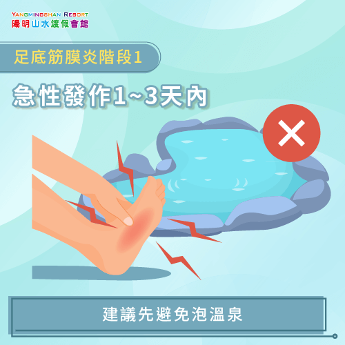 急性發作建議先避免泡溫泉-足底筋膜炎 泡溫泉